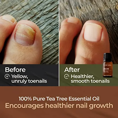 Pure Australian Tea Tree Oil for Skin, Hair, Face & Toenails